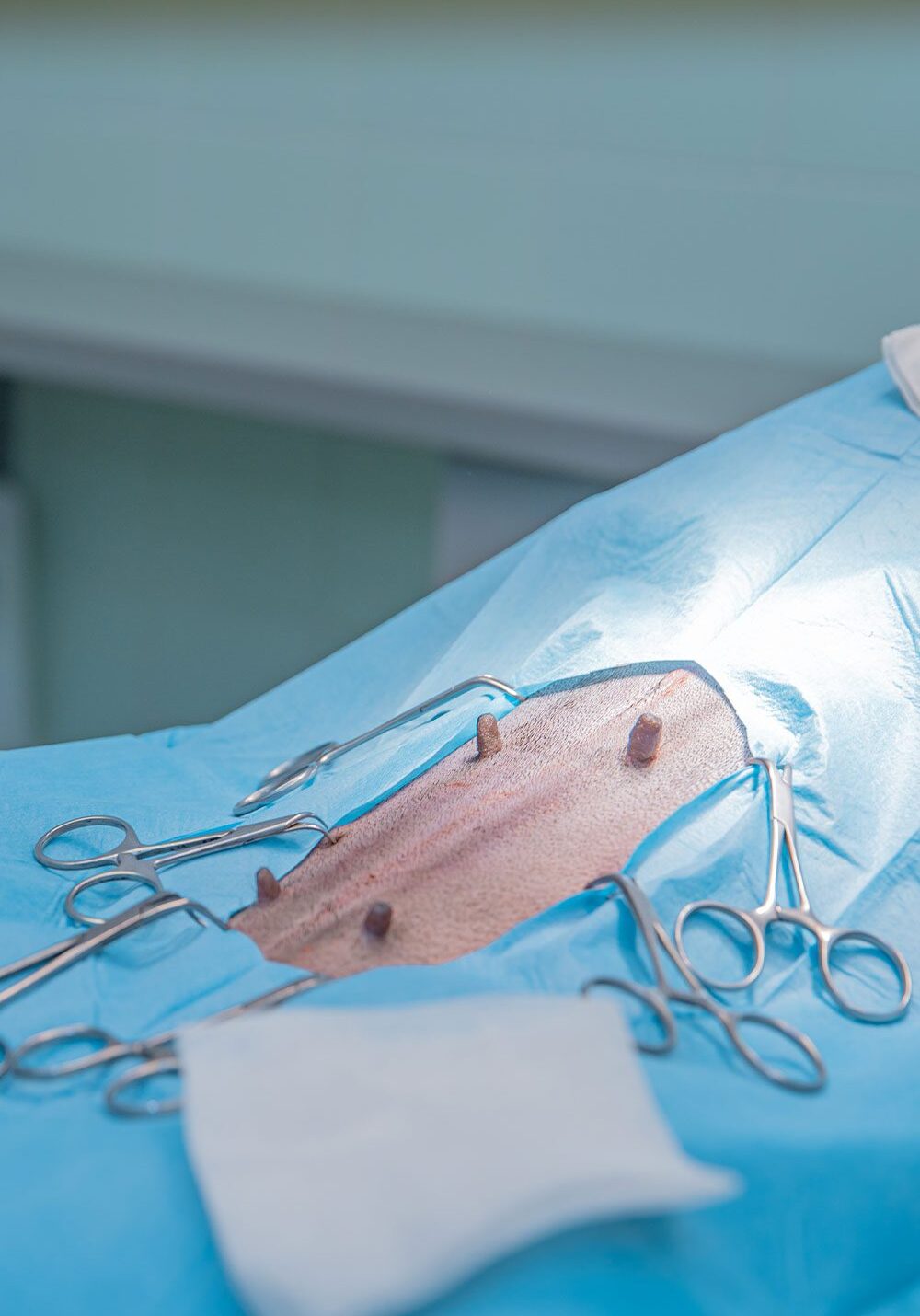 dog's abdomen draped with surgical covers and prepped for spay surgery